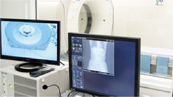 CT（80列検出器/160スライスCT）