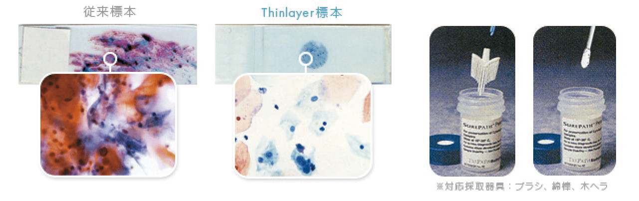 Thinlayer法